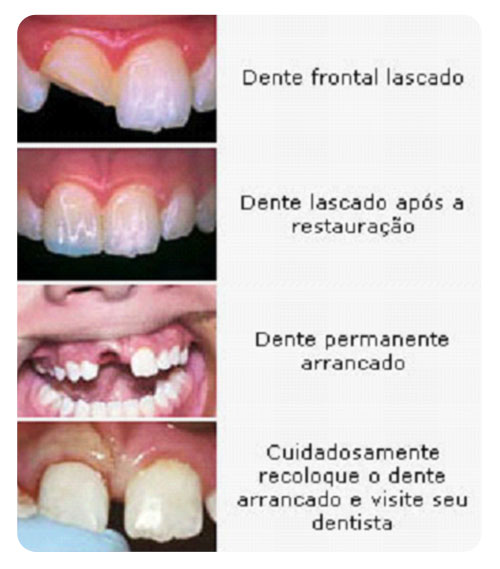 emergencia